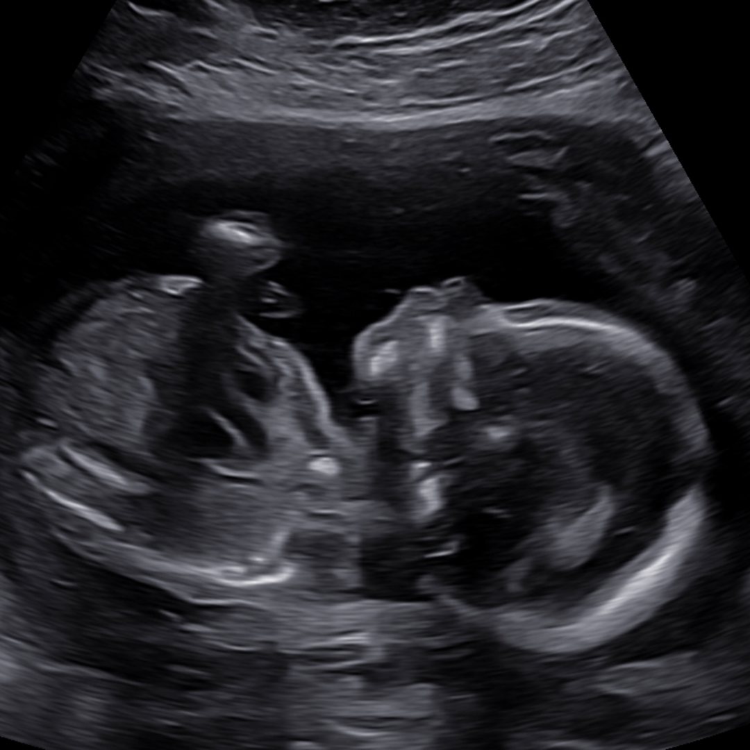 Photo shared by Amber for their Babylist baby registry.