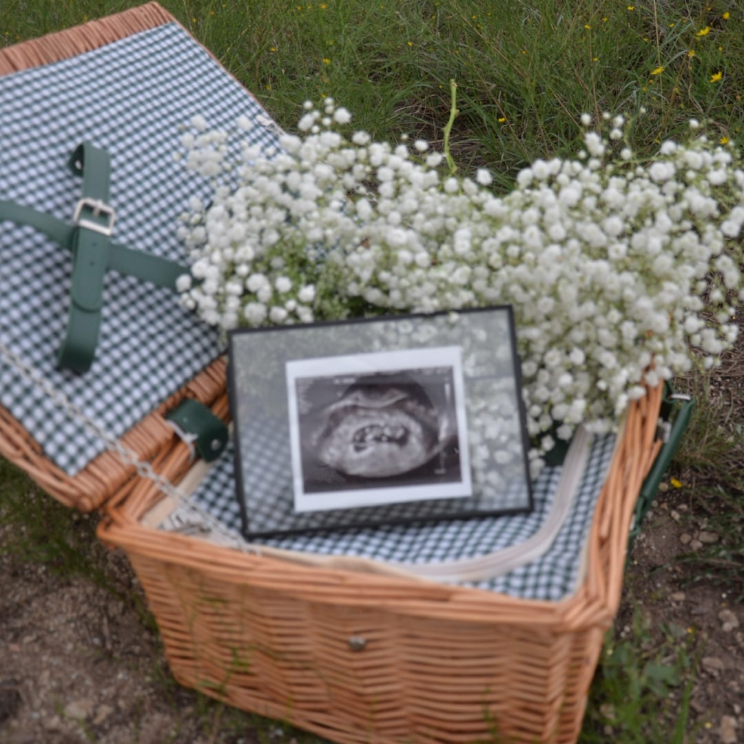 Photo shared by Brayleigh for their Babylist baby registry.