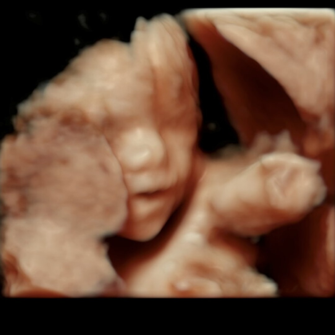 Photo shared by Christina for their Babylist baby registry.
