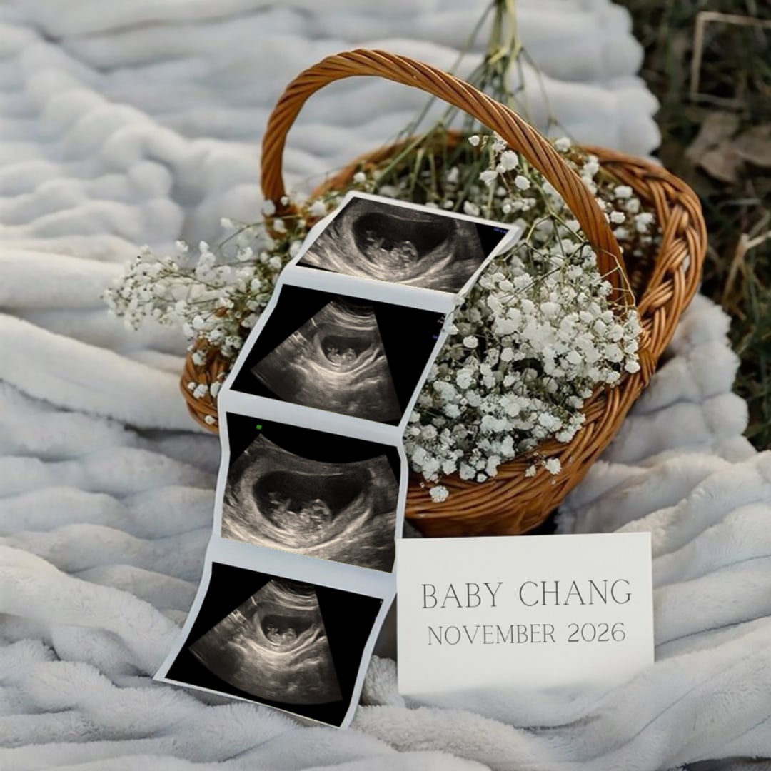 Photo shared by Abigail for their Babylist baby registry.