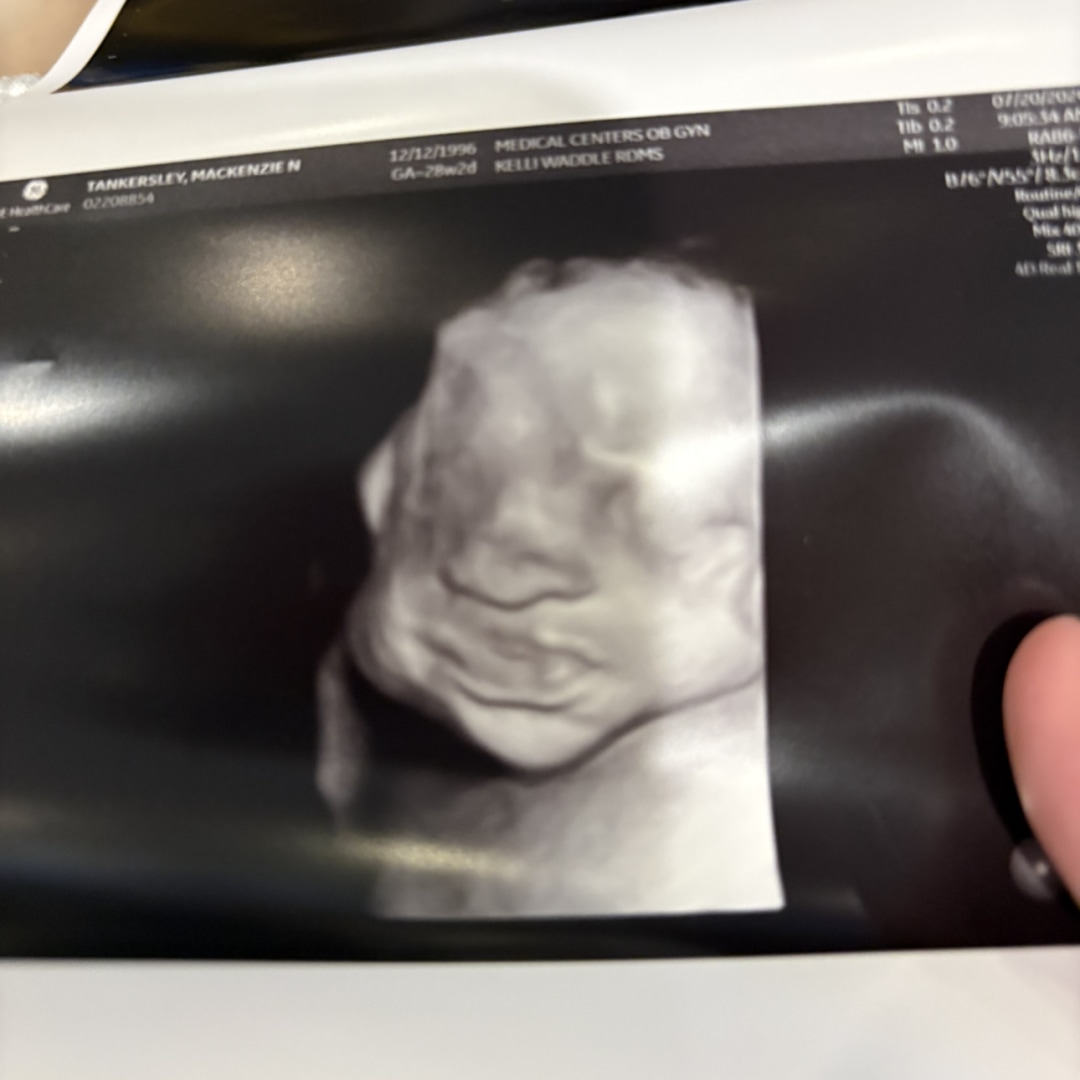 Photo shared by Mackenzie for their Babylist baby registry.