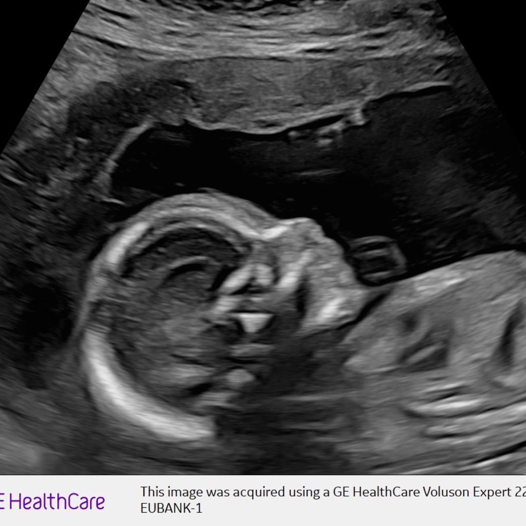 Photo shared by Ashley for their Babylist baby registry.