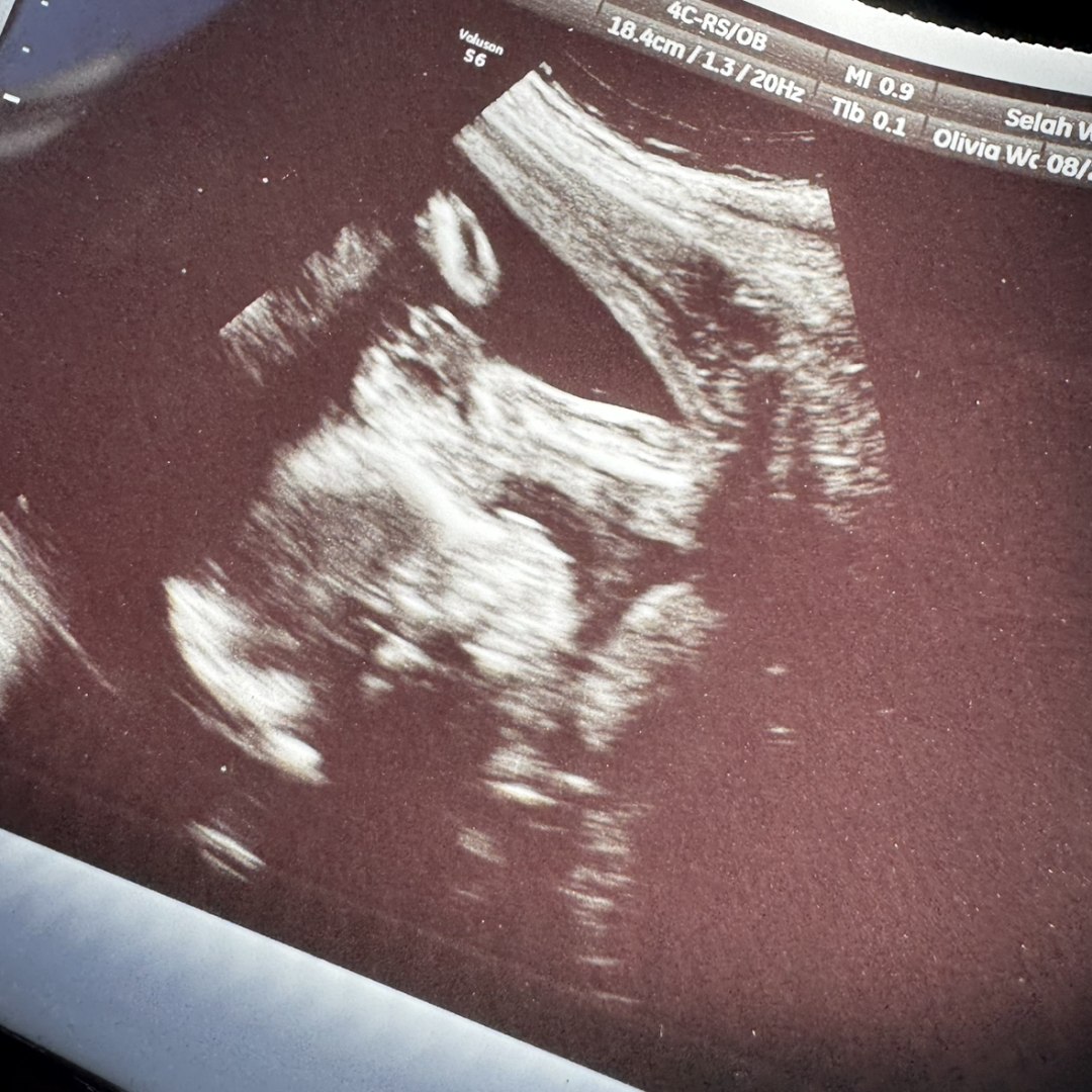 Photo shared by Linda for their Babylist baby registry.