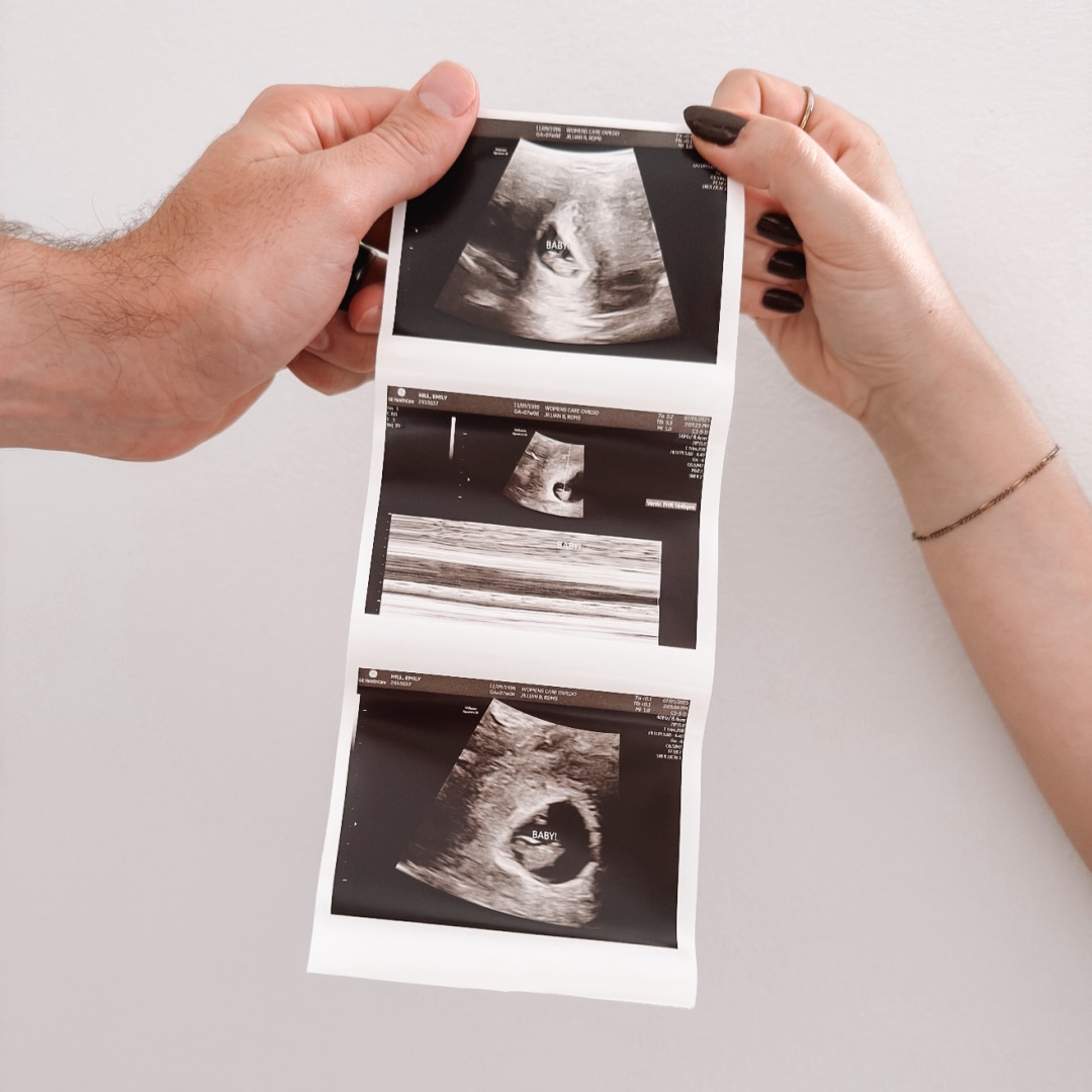 Photo shared by Emily for their Babylist baby registry.