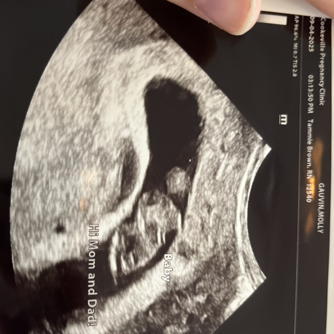 Photo shared by Molly for their Babylist baby registry.