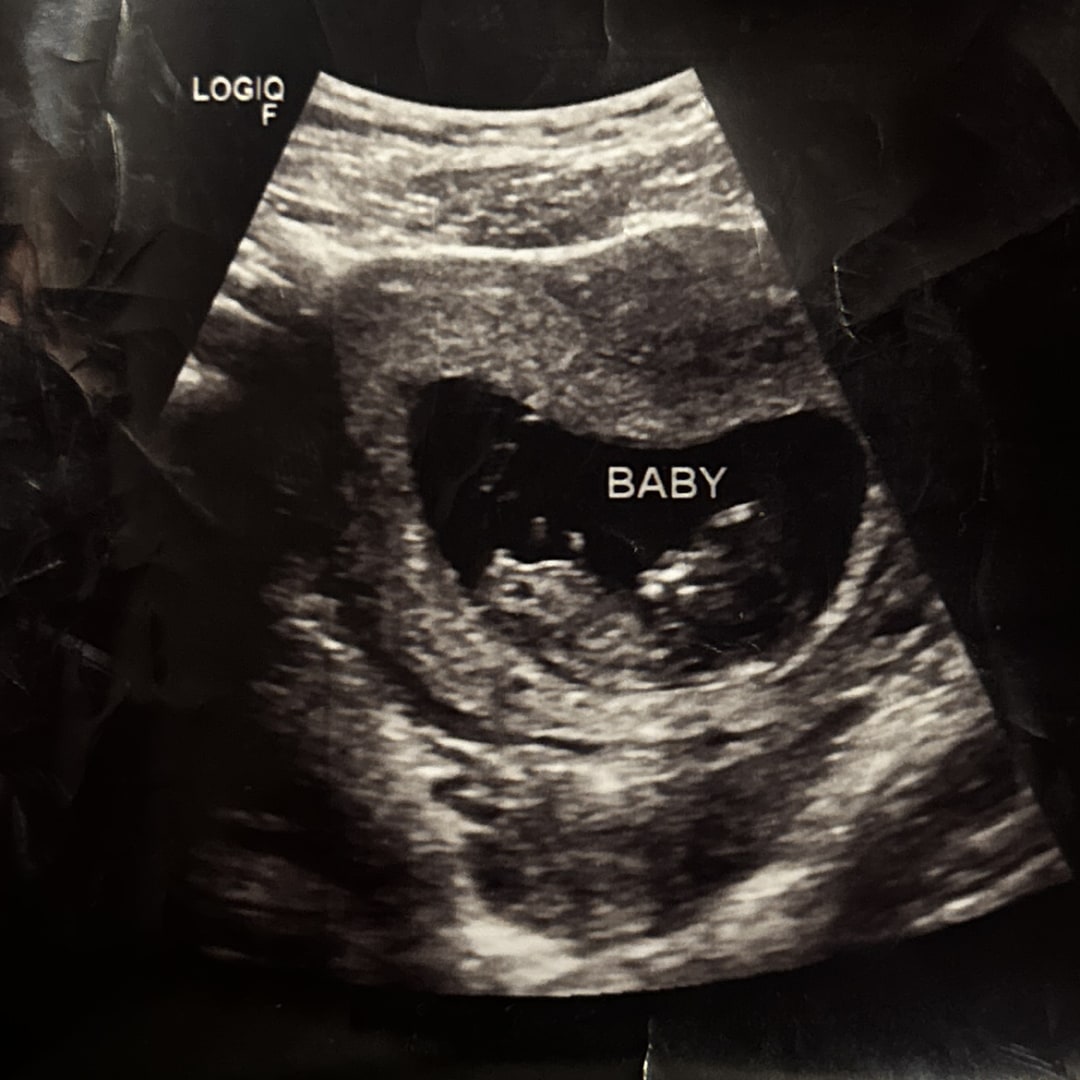 Photo shared by Ansley for their Babylist baby registry.