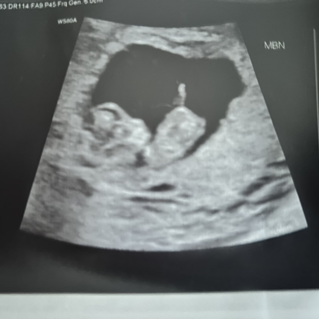 Photo shared by Caitlin for their Babylist baby registry.