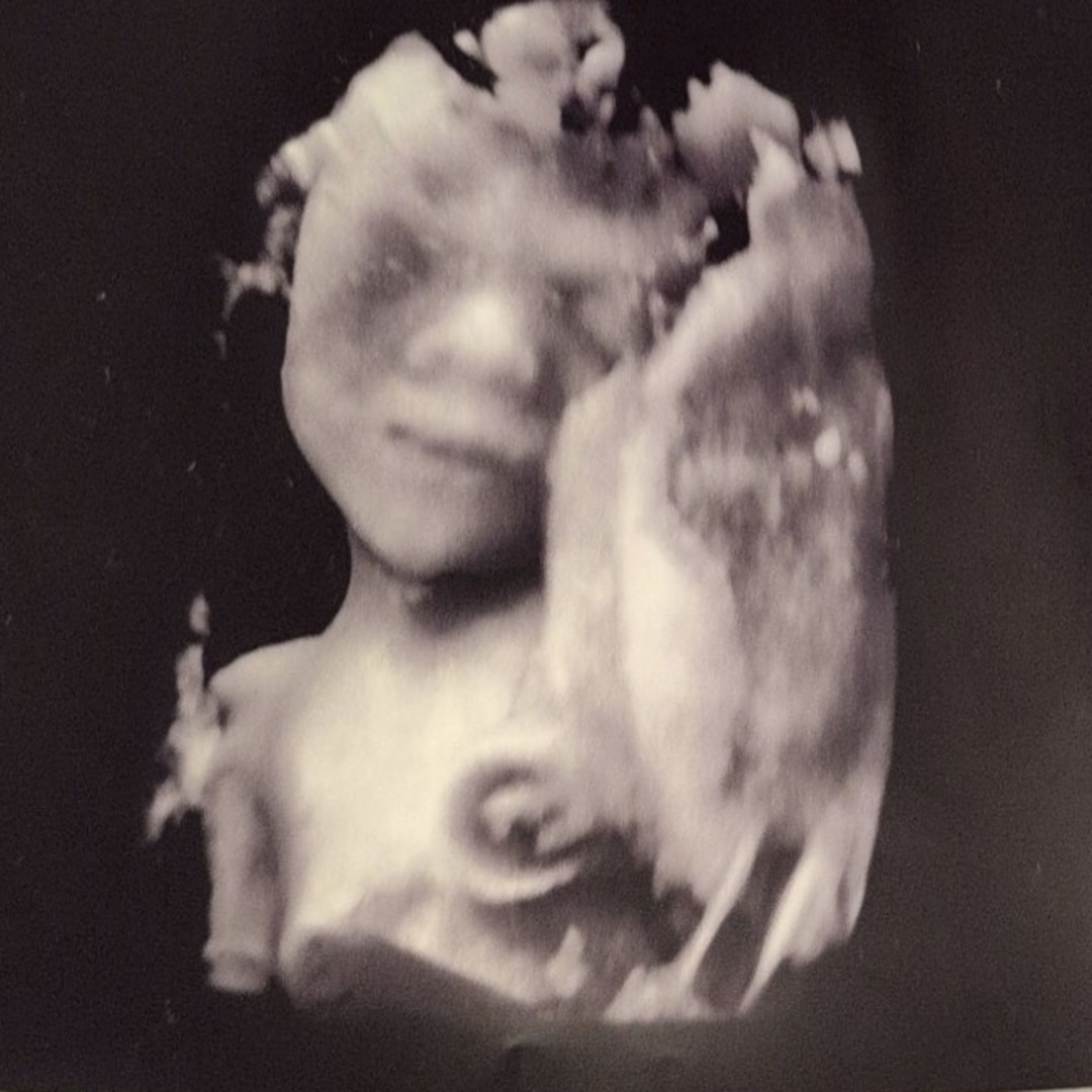 Photo shared by Wendy for their Babylist baby registry.