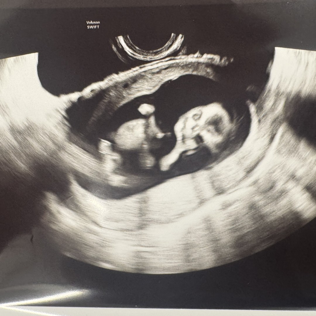 Photo shared by Cassie for their Babylist baby registry.