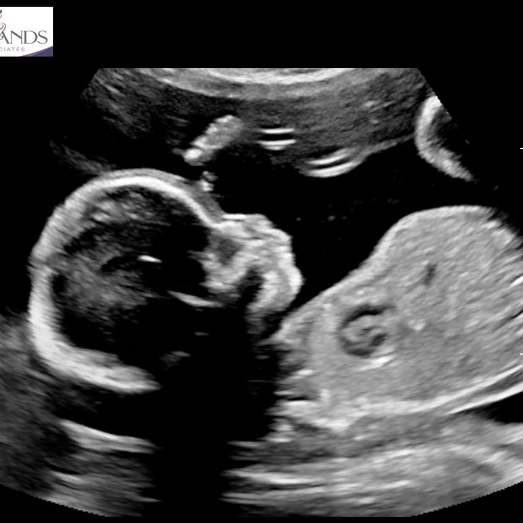 Photo shared by Samantha for their Babylist baby registry.