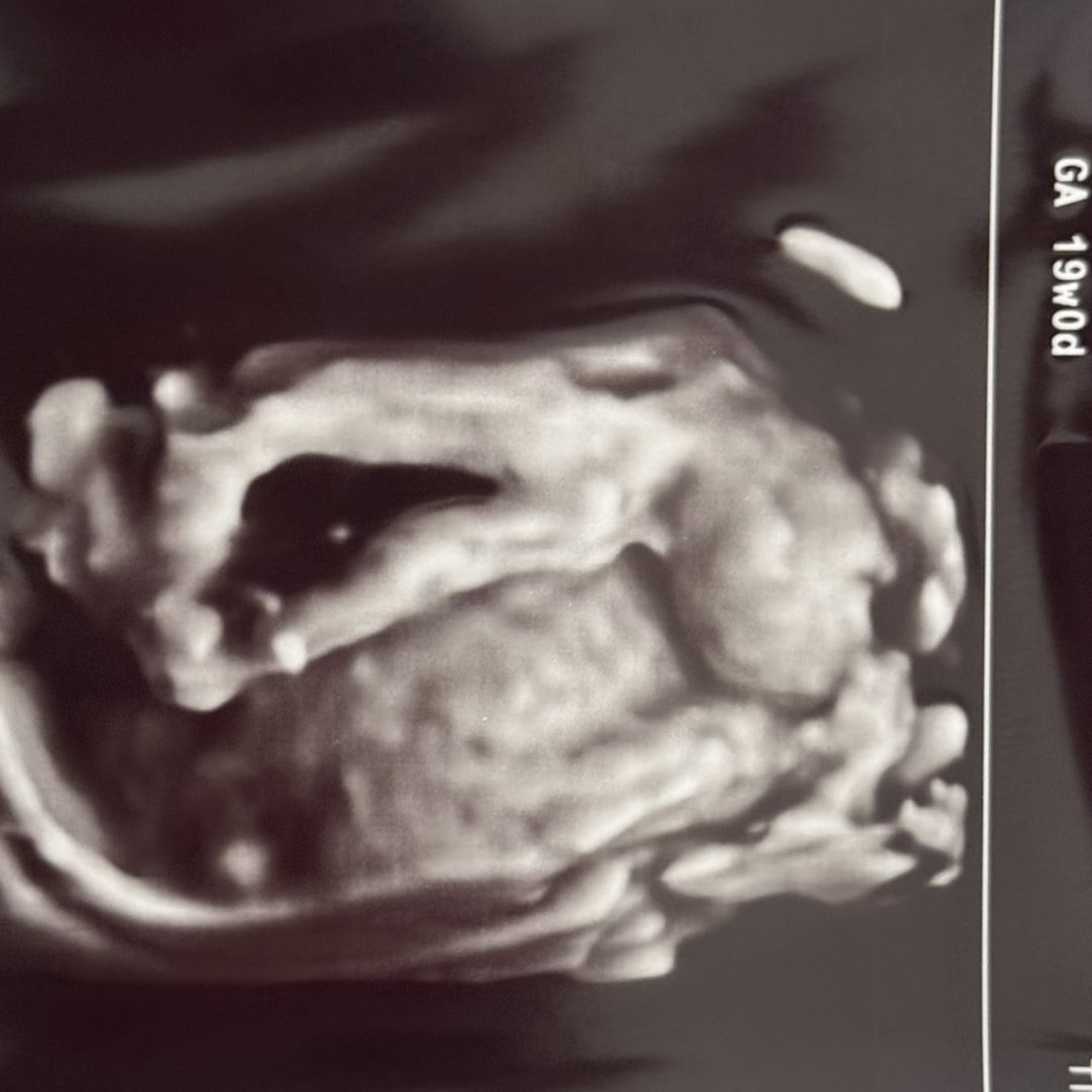 Photo shared by Anne for their Babylist baby registry.