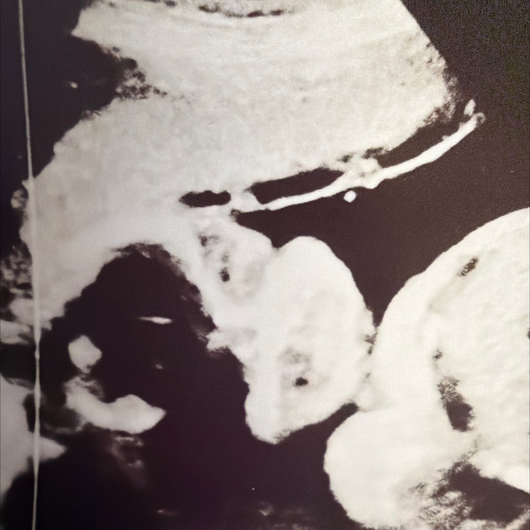 Photo shared by Marie for their Babylist baby registry.