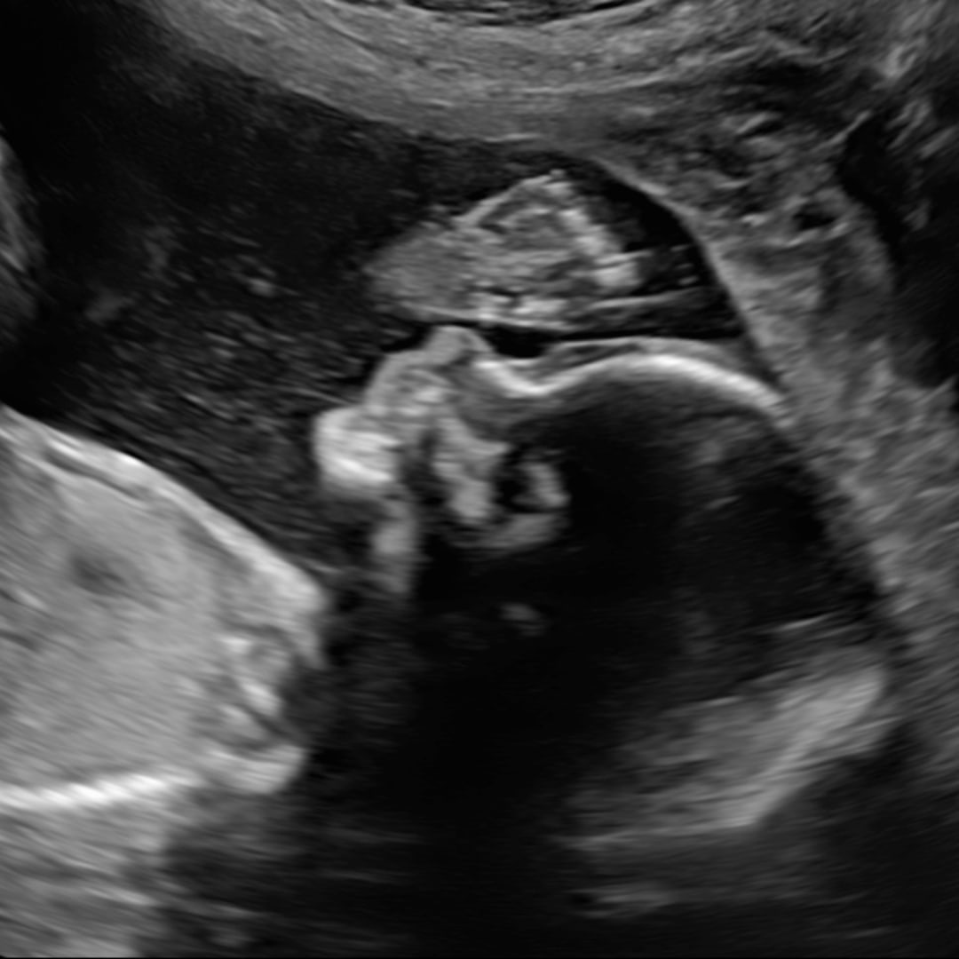 Photo shared by Winter for their Babylist baby registry.