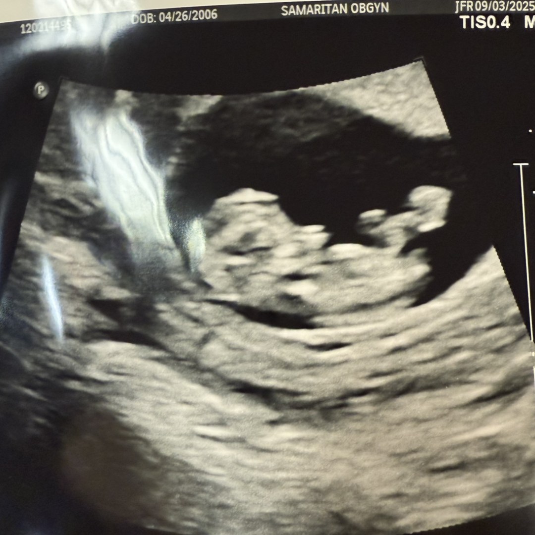 Photo shared by Nikki for their Babylist baby registry.