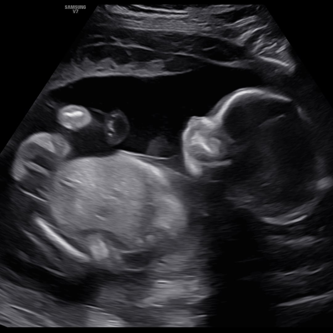 Photo shared by Amber for their Babylist baby registry.