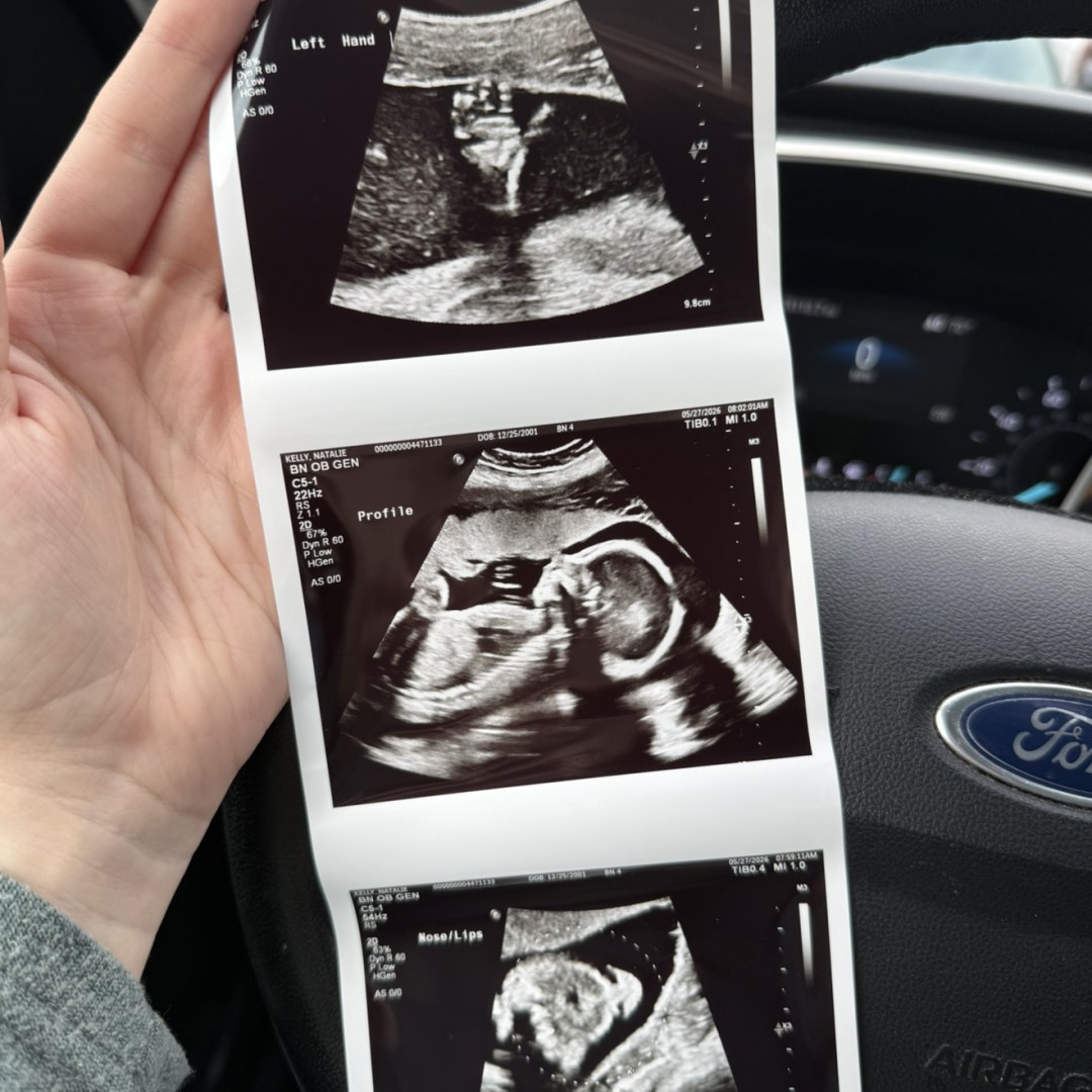 Photo shared by Natalie for their Babylist baby registry.