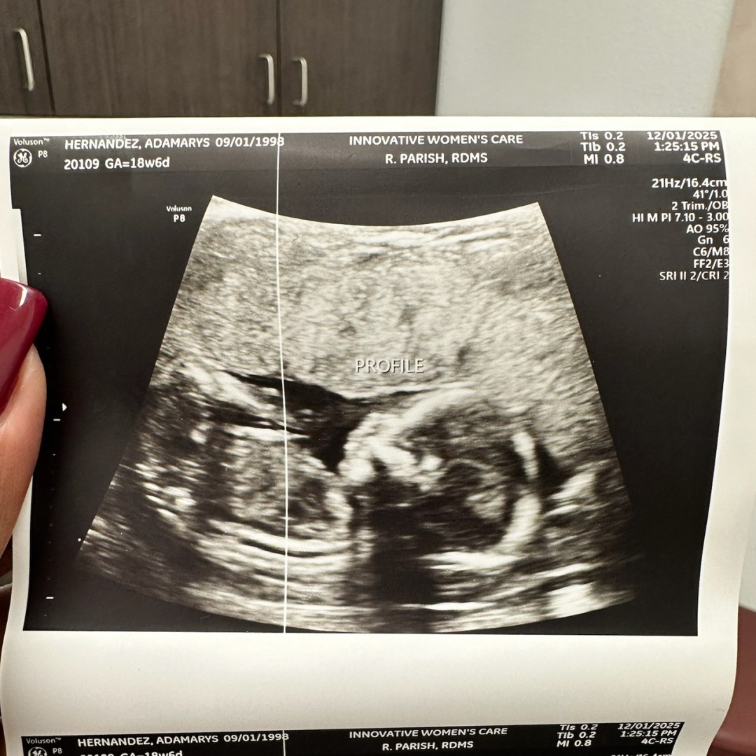 Photo shared by Adamarys for their Babylist baby registry.