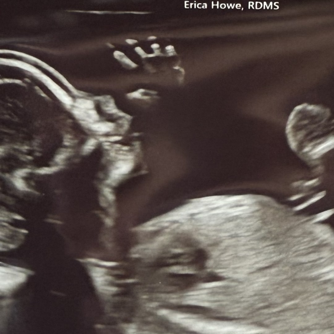 Photo shared by Kelsey for their Babylist baby registry.