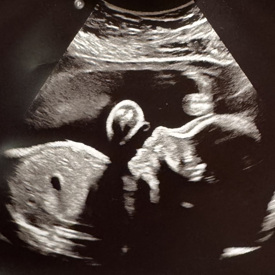 Photo shared by Lizbeth for their Babylist baby registry.