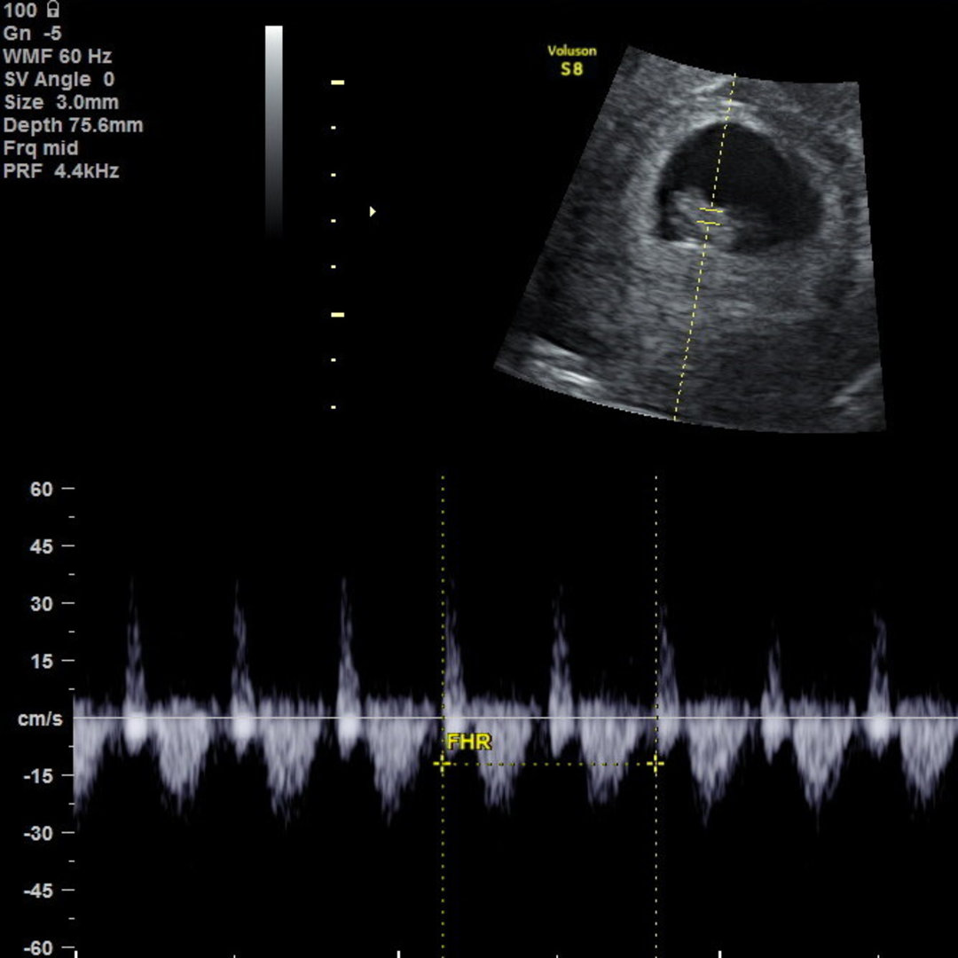 Photo shared by Felicia for their Babylist baby registry.