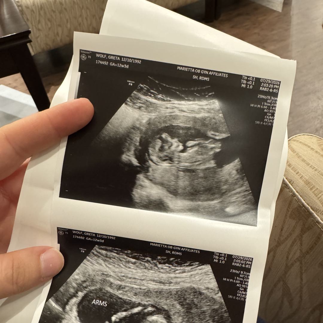 Photo shared by Greta for their Babylist baby registry.