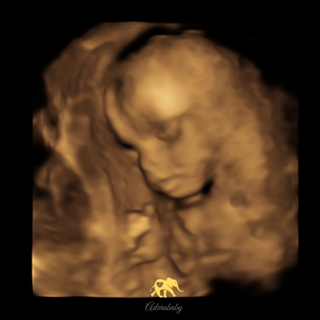 Photo shared by Chelsea for their Babylist baby registry.