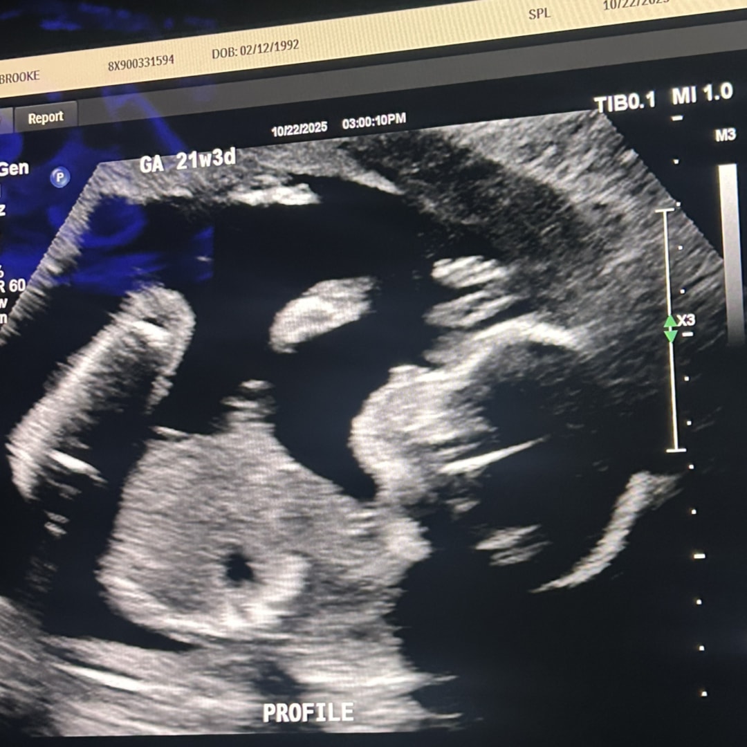 Photo shared by Brooke for their Babylist baby registry.