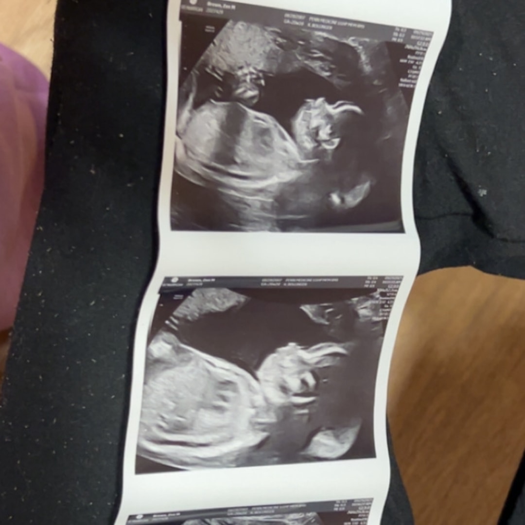 Photo shared by Zen for their Babylist baby registry.