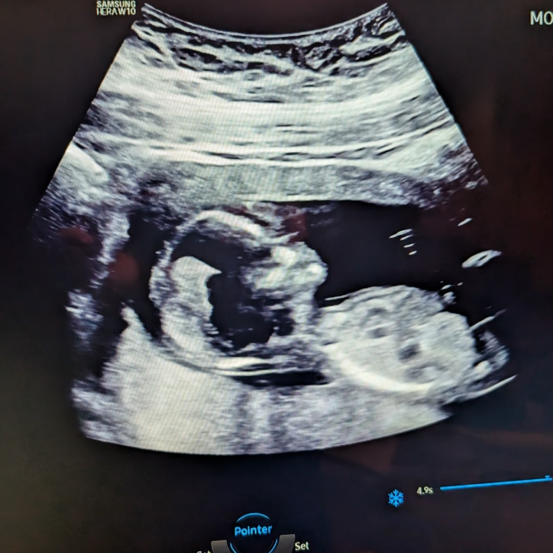 Photo shared by Ashlyn for their Babylist baby registry.