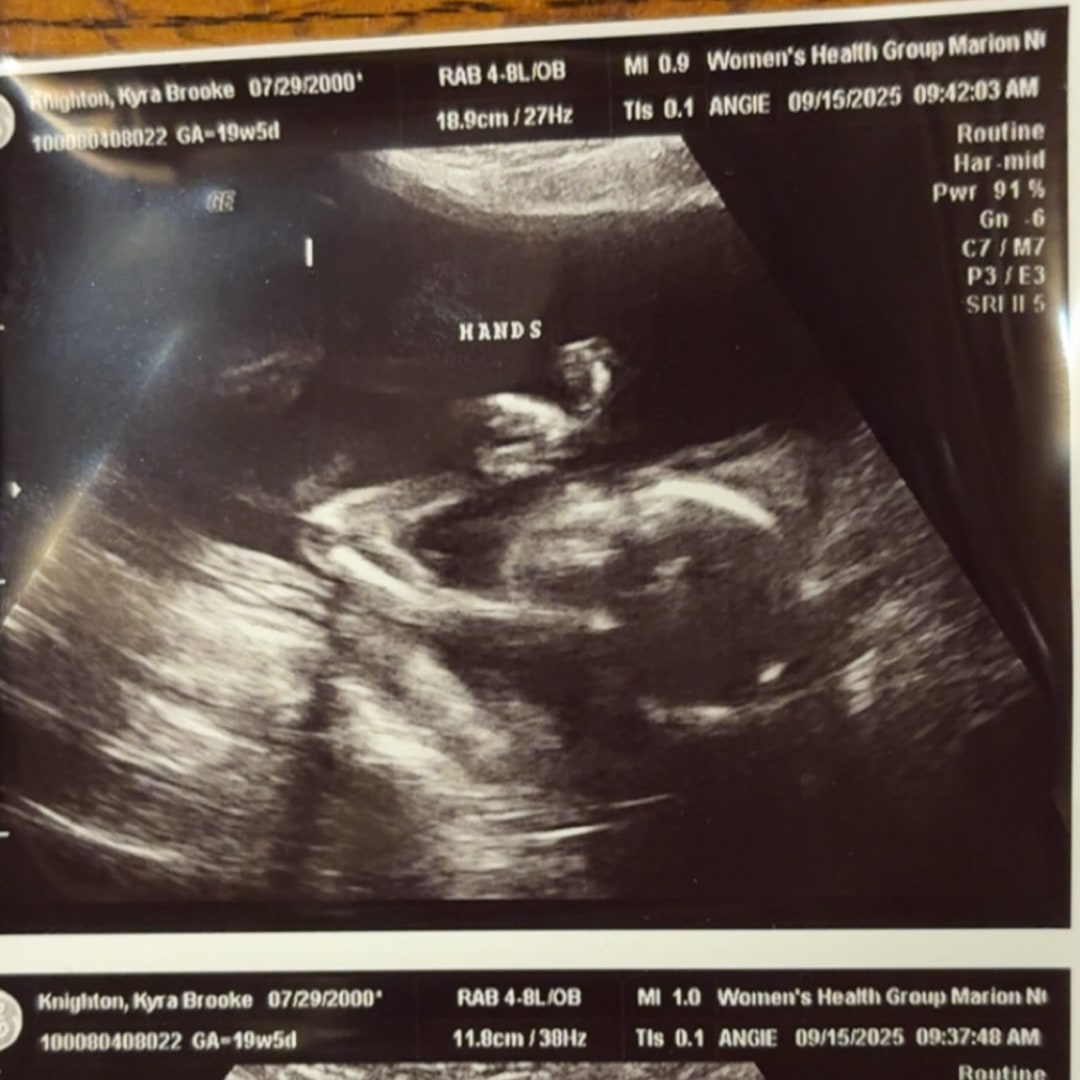 Photo shared by Kyra for their Babylist baby registry.