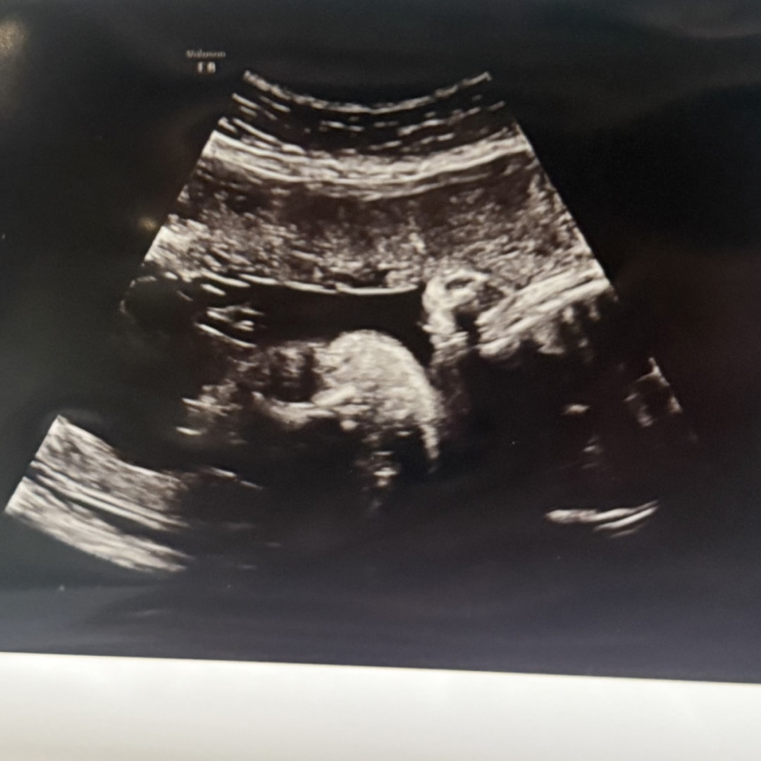 Photo shared by Alexis for their Babylist baby registry.
