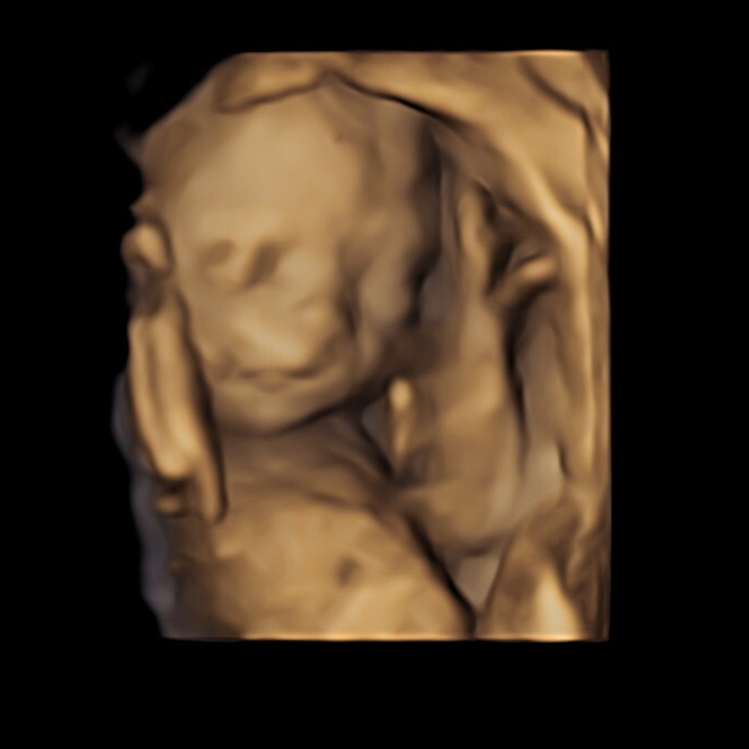 Photo shared by Erika for their Babylist baby registry.