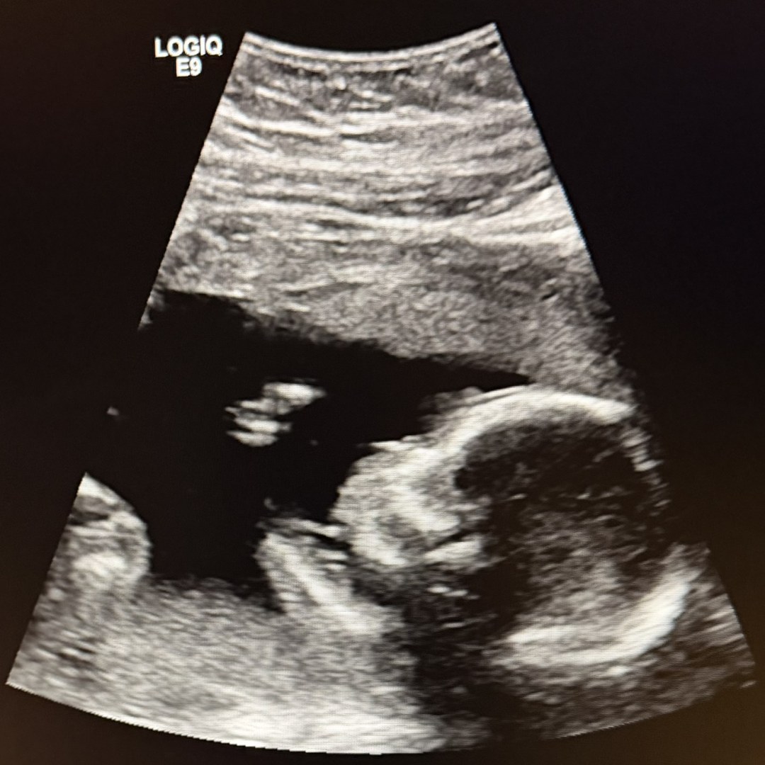 Photo shared by Veronica for their Babylist baby registry.