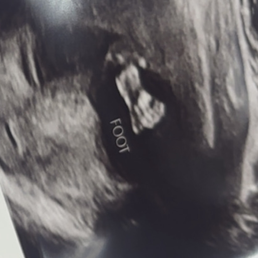 Photo shared by Brooklynne for their Babylist baby registry.