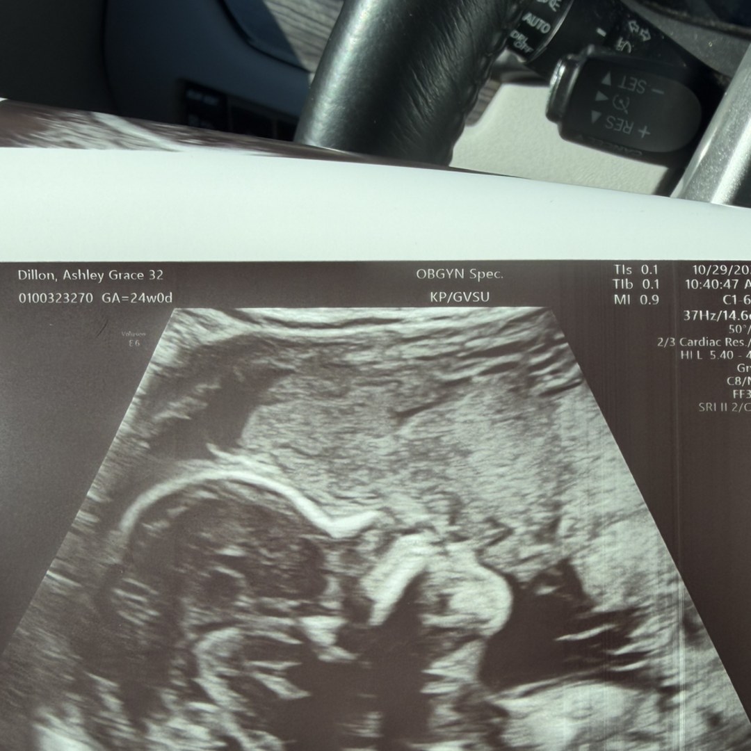 Photo shared by Ashley for their Babylist baby registry.