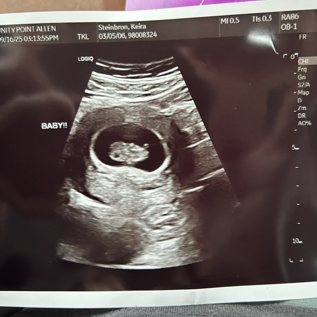 Photo shared by Keira for their Babylist baby registry.