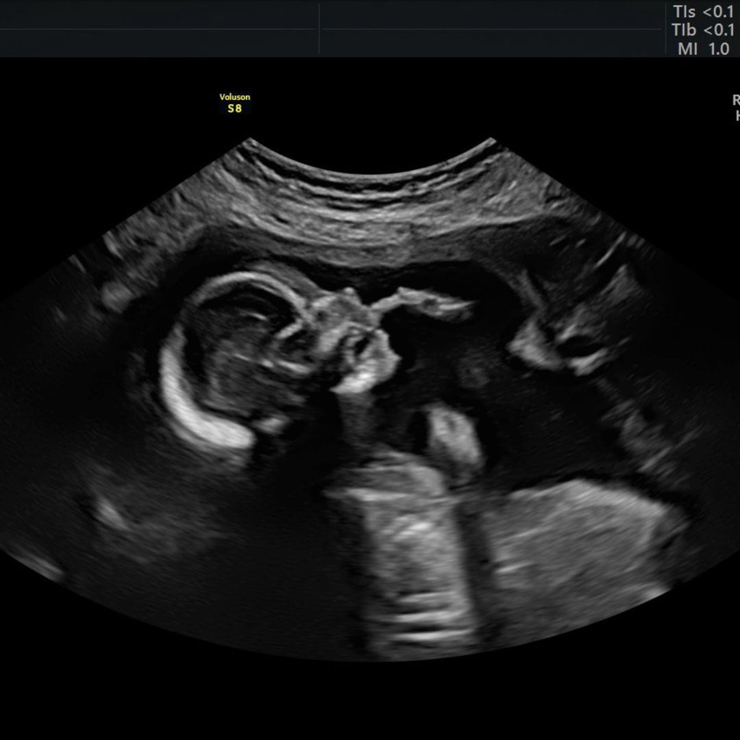 Photo shared by Kennedy for their Babylist baby registry.