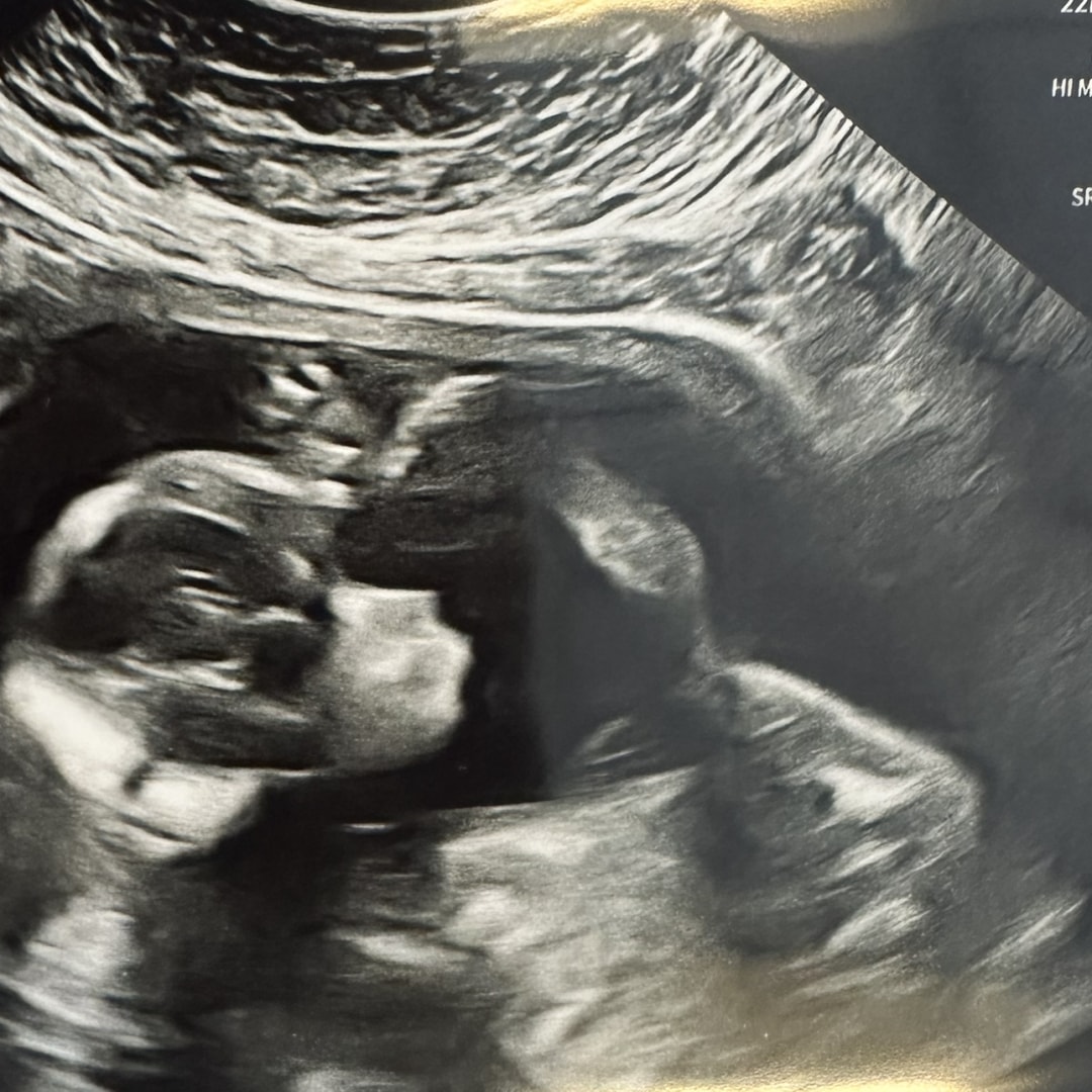 Photo shared by Ashley for their Babylist baby registry.