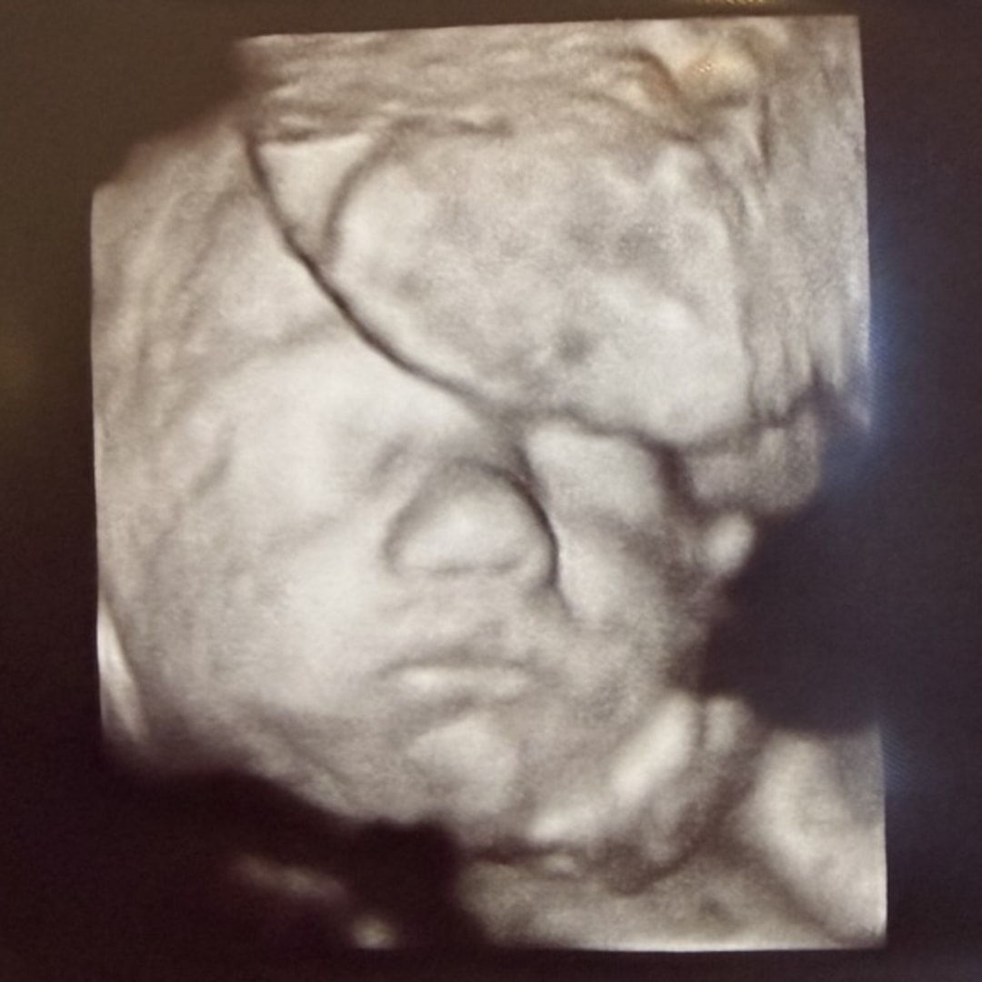 Photo shared by Shelby for their Babylist baby registry.