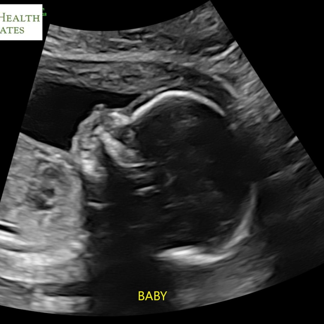 Photo shared by Jaida for their Babylist baby registry.