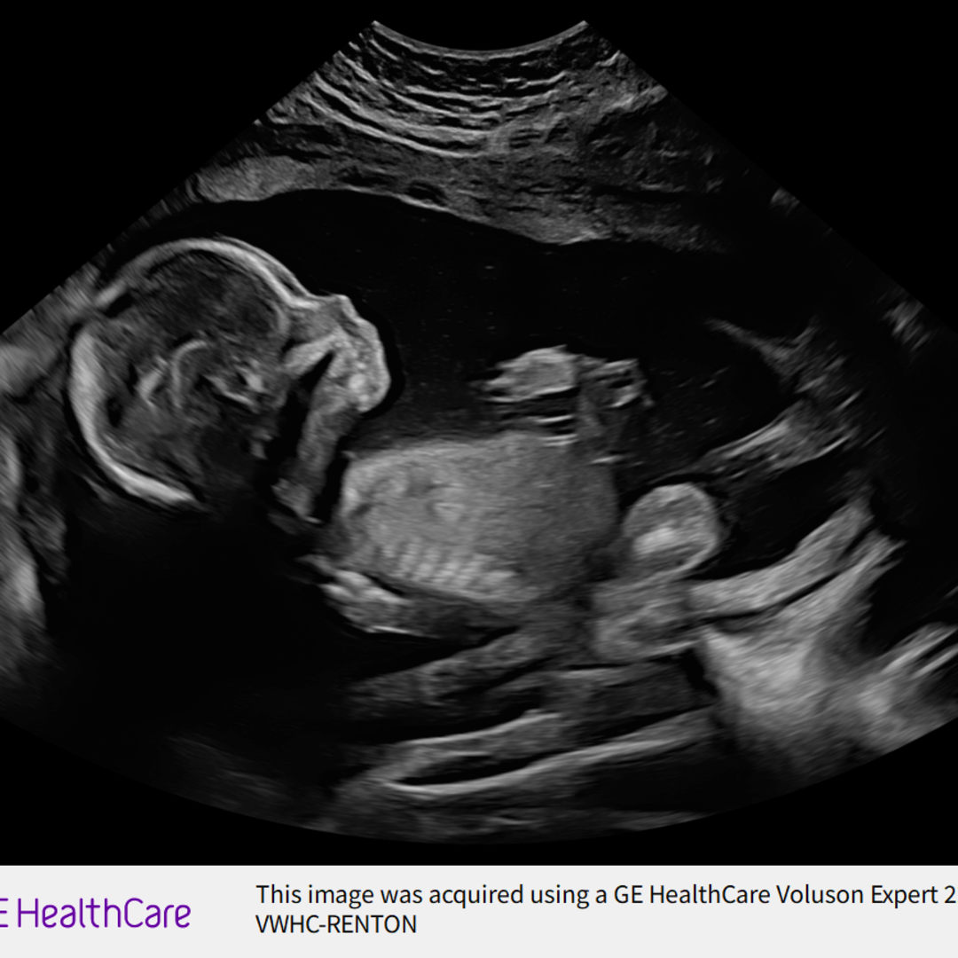 Photo shared by Linh for their Babylist baby registry.