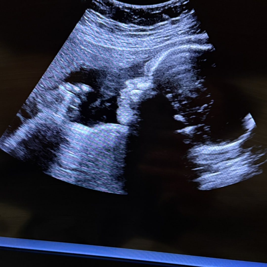 Photo shared by Kelsey for their Babylist baby registry.