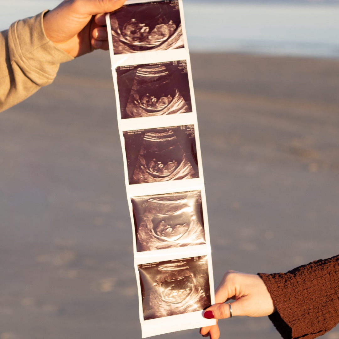 Photo shared by Mikayla for their Babylist baby registry.