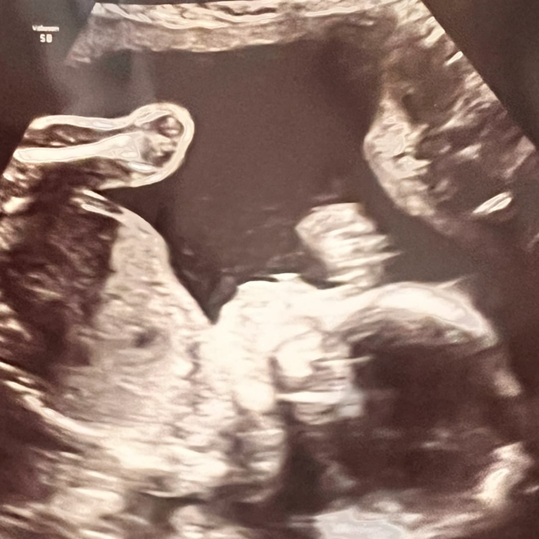 Photo shared by Jennifer for their Babylist baby registry.