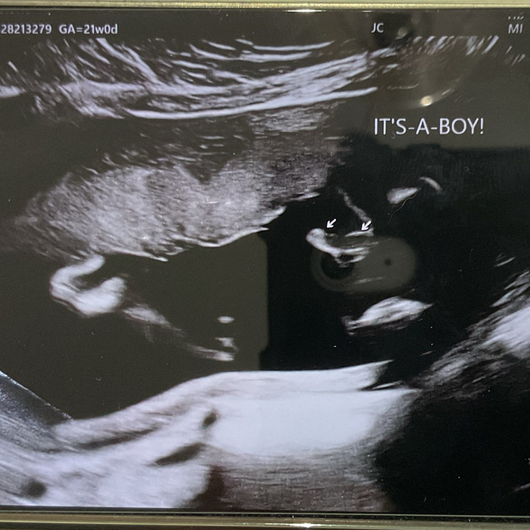 Photo shared by Jenna for their Babylist baby registry.