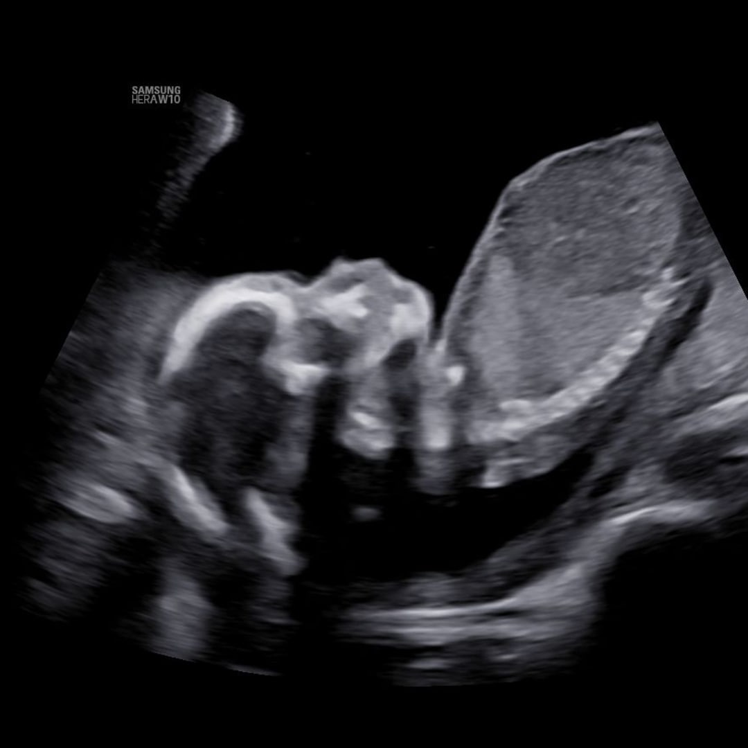 Photo shared by Adrianna for their Babylist baby registry.