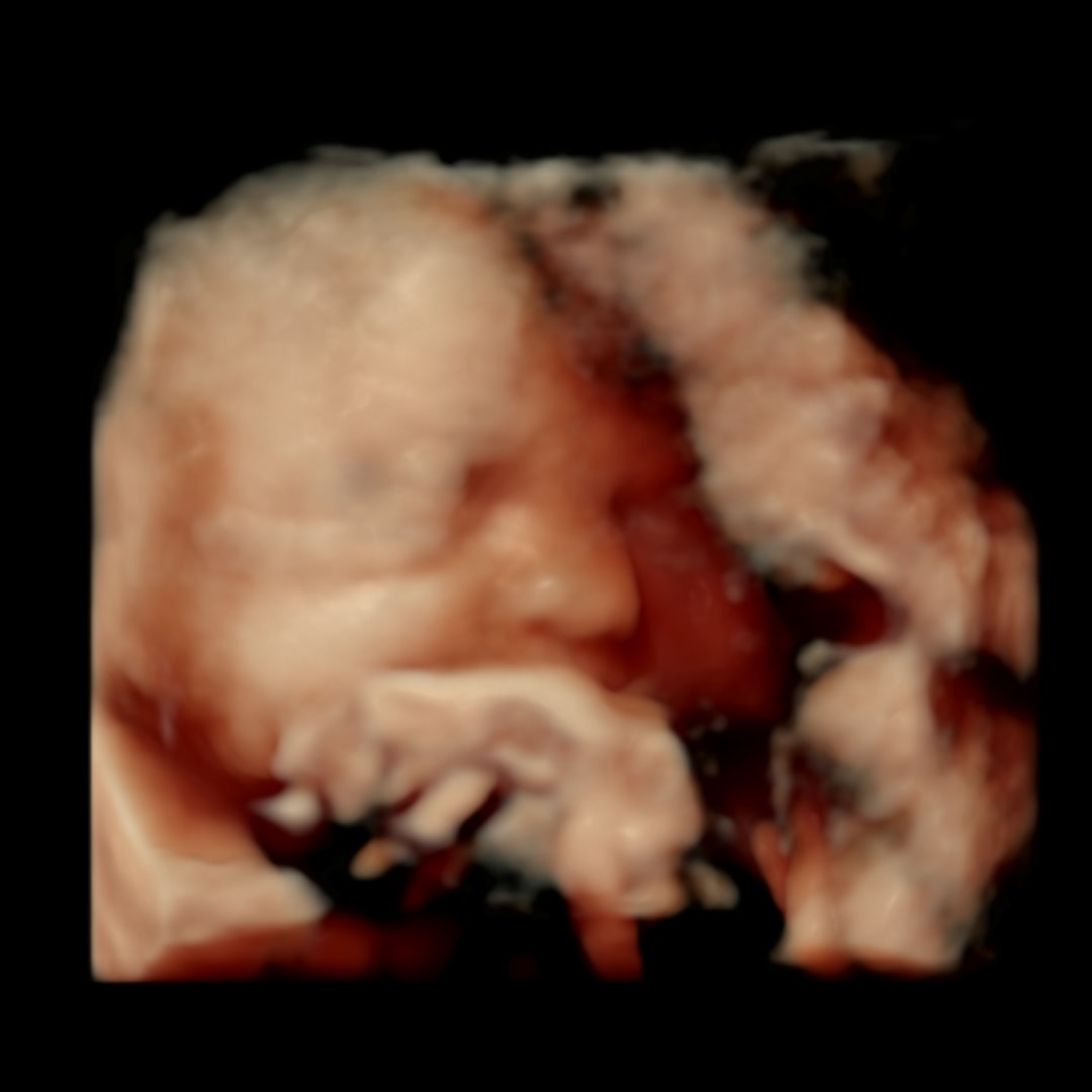 Photo shared by Dora for their Babylist baby registry.