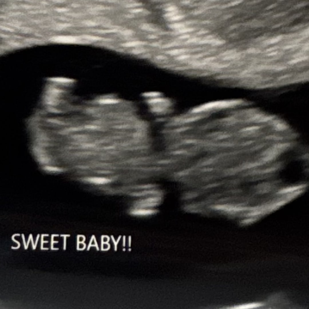 Photo shared by Lisa for their Babylist baby registry.