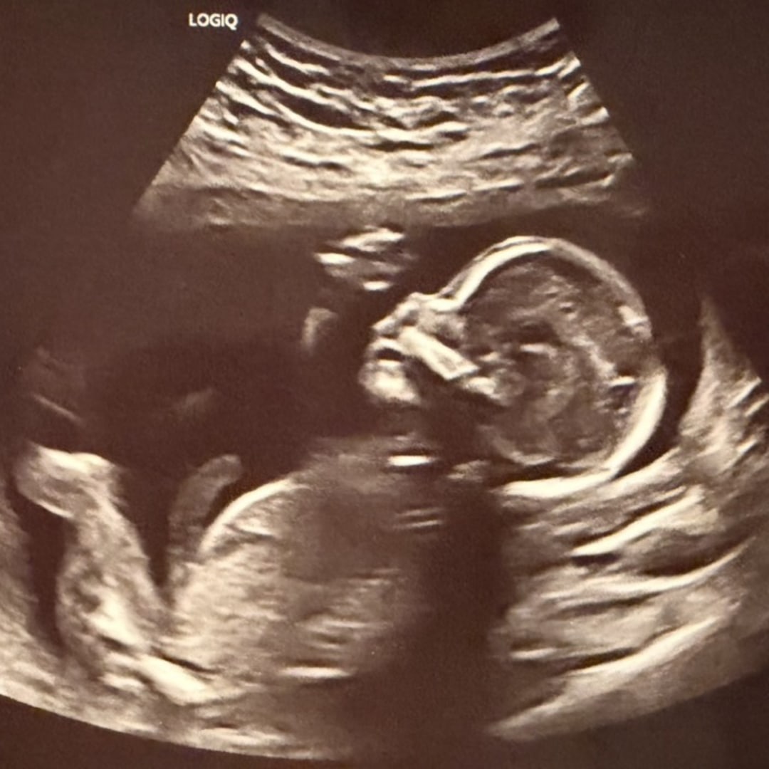 Photo shared by Charlie for their Babylist baby registry.