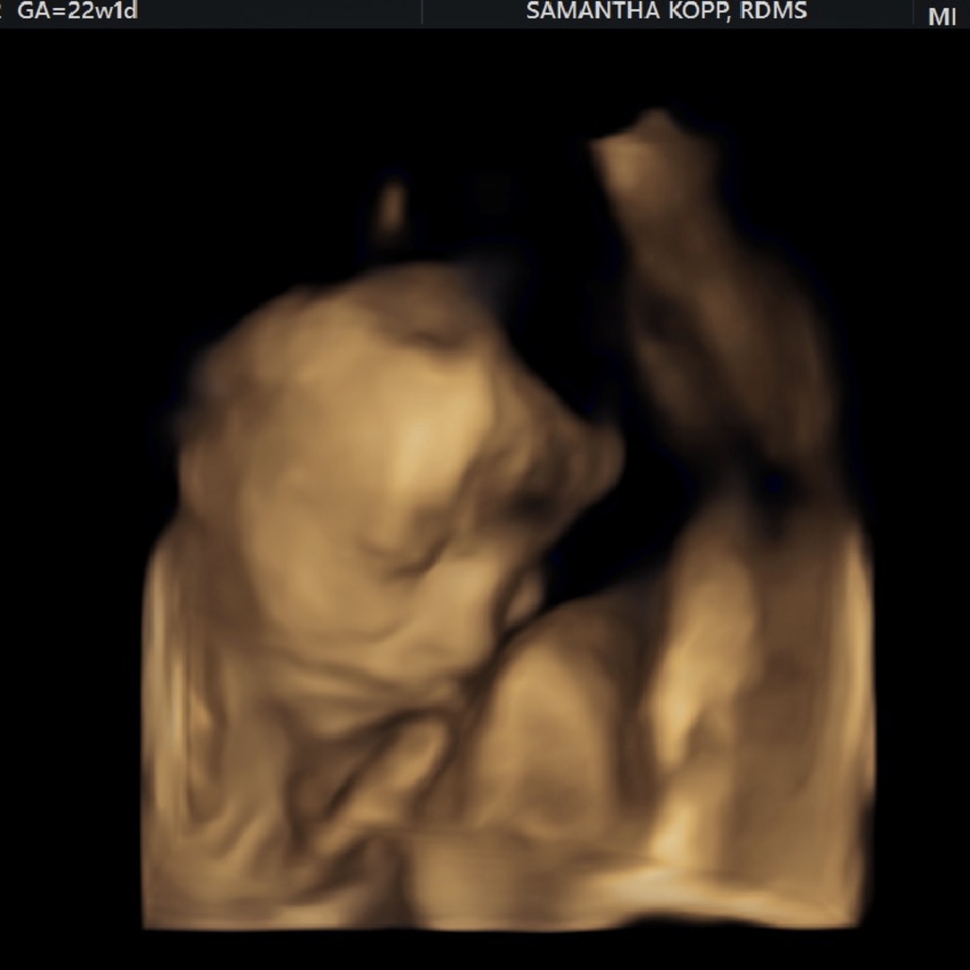 Photo shared by Patience for their Babylist baby registry.
